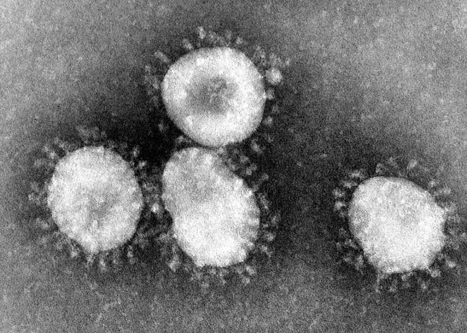 일반적으로 감기를 유발하는 코로나바이러스의 모습이다. 위키미디어 제공.jpg