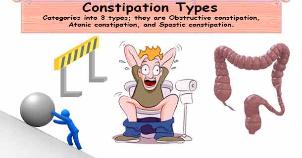 Constipation Types.jpg
