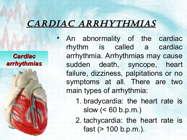 cardiac-arrhythmias.jpg