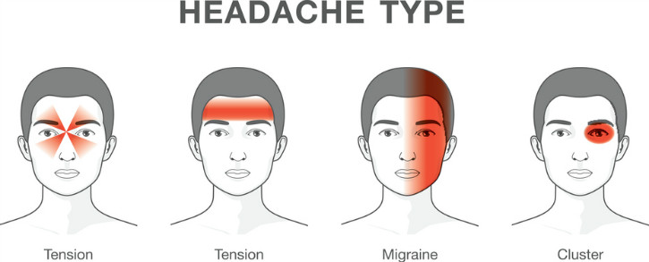 headache-migraine.jpg