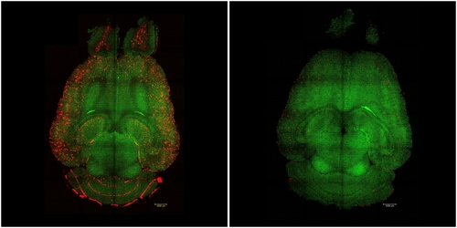 나노입자 투여 전과 후 생쥐 뇌 사진 비교.jpg
